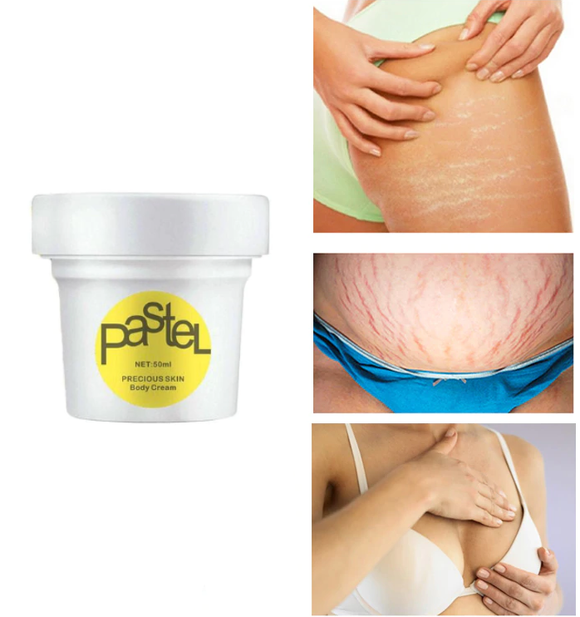 Natural Anti Cellulite Skin Firming Cream - UptownFab™